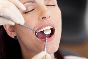 Cómo se Realiza una Profilaxis Dental Ekran Görüntüsü 1