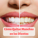 Cómo Quitar Manchas en los Dientes APK