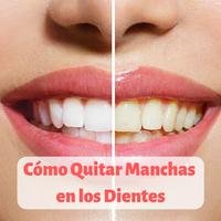 Cómo Quitar Manchas en los Dientes gönderen