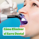 Cómo Eliminar Sarro Dental APK