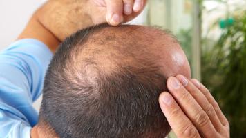 Remedios para hacer Crecer el Cabello Rápido Ekran Görüntüsü 1