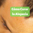 Cómo Curar la Alopecia de forma Natural APK