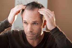 Cómo Curar la Alopecia de forma Natural Ekran Görüntüsü 3