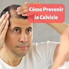 Cómo Prevenir la Calvicie Naturalmente simgesi