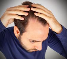 Cómo Prevenir la Calvicie Naturalmente Ekran Görüntüsü 1