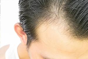 Trucos para Detener la Caída del Cabello Ekran Görüntüsü 1