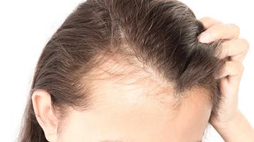 Solución Natural para la Caída del Cabello Ekran Görüntüsü 1