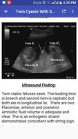 پوستر Ultrasound Guide
