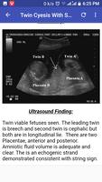 Ultrasound Guide Affiche