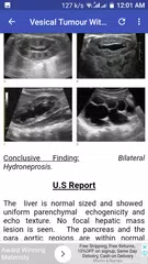 Descargar APK de Ultrasound Guide A2Z