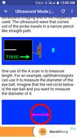 Ultrasound Guide تصوير الشاشة 1