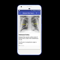 X-Ray Interpretation Guide 포스터