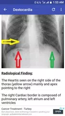 X-Ray Interpretation Guide APK download