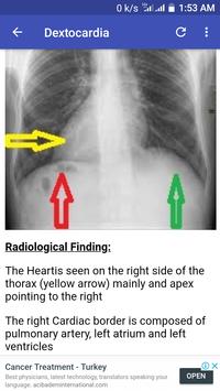 X-Ray Interpretation Guide screenshot 5