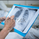 Chest X-Ray Based Cases آئیکن