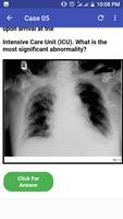 Chest X-Ray Based Cases 截图 3