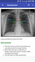 Chest X-Ray Based Cases ポスター