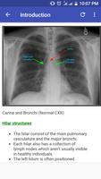 Chest X-Ray Based Cases Affiche