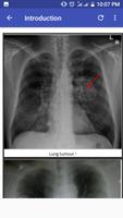 Chest X-Ray Based Cases capture d'écran 1