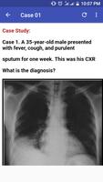 Chest X-Ray Based Cases اسکرین شاٹ 2