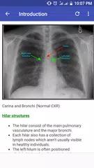 Chest X-Ray Based Cases APK download
