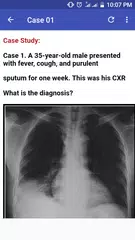 Chest X-Ray Based Cases APK download