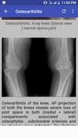 Bone X Ray Interpretation (Mus gönderen