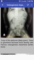 Bone X Ray Interpretation (Mus capture d'écran 1