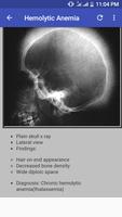 Bone X Ray Interpretation (Mus Ekran Görüntüsü 2