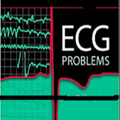ECG Cases
