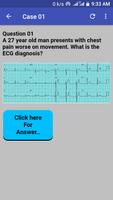 ECG Cases 스크린샷 3