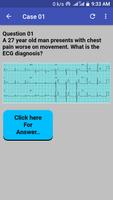 ECG Cases capture d'écran 3