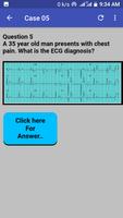 ECG Cases capture d'écran 2