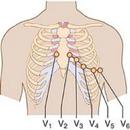 APK Clinical ECG Guide.