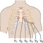 Clinical ECG Guide. آئیکن