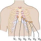 Clinical ECG Guide. 图标