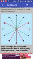 Clinical ECG Guide. اسکرین شاٹ 3