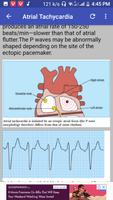 Clinical ECG Guide. پوسٹر