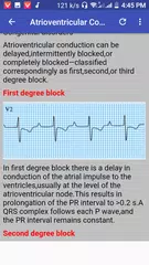 Clinical ECG Guide. APK download