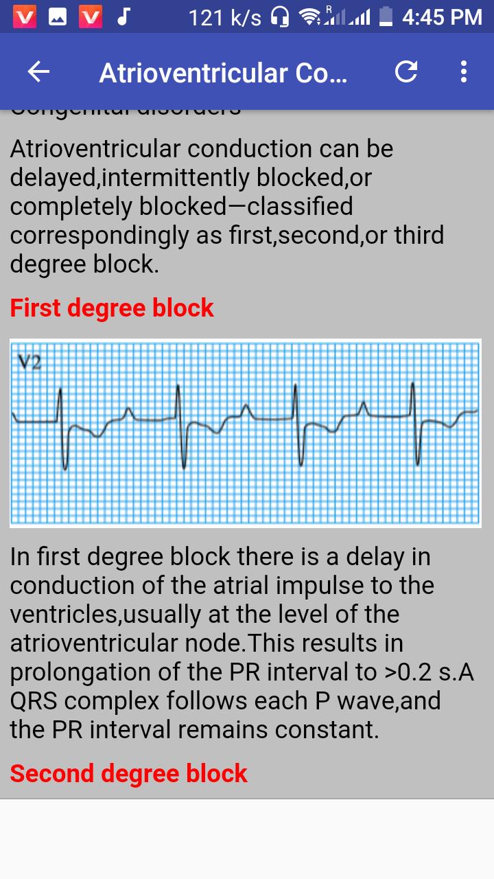 ecg guide ecg guide