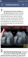 Ultrasound Guide poster