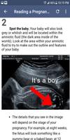 Ultrasound Guide screenshot 1
