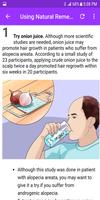 برنامه‌نما Treat your Hair Loss عکس از صفحه