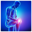 Osteoarthritis