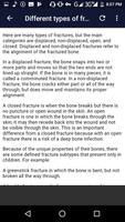 Fracture स्क्रीनशॉट 1