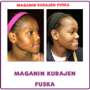 Maganin Kurajen Fuska APK