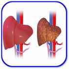 How to Recognize Cirrhosis simgesi