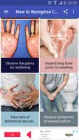 How to Recognize Cirrhosis gönderen