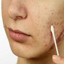 Basics of All Skin Diseases APK