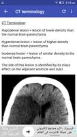 Stroke In CT পোস্টার
